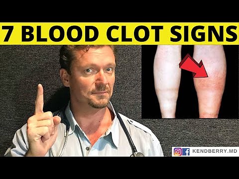 7 Warning Signs of a BLOOD CLOT (Symptoms) 2024