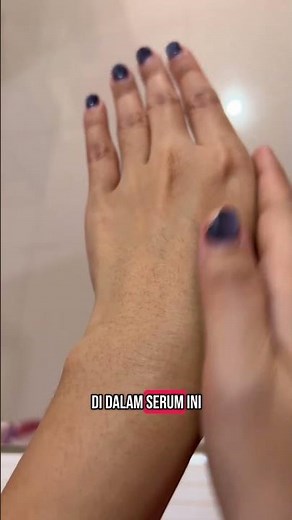 Penghilang Bekas Luka Bagus dan Murah || Review Lauskin Ruby Glow #bodycare #lauskin