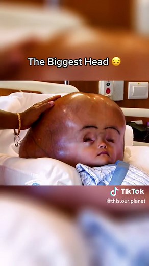 Largest Body Parts Compilation: Jaw-Dropping Encounters