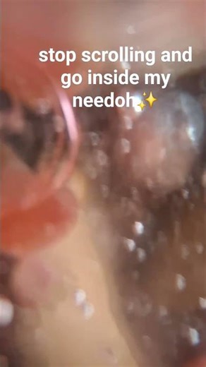 stop scrolling and go inside my needoh✨️