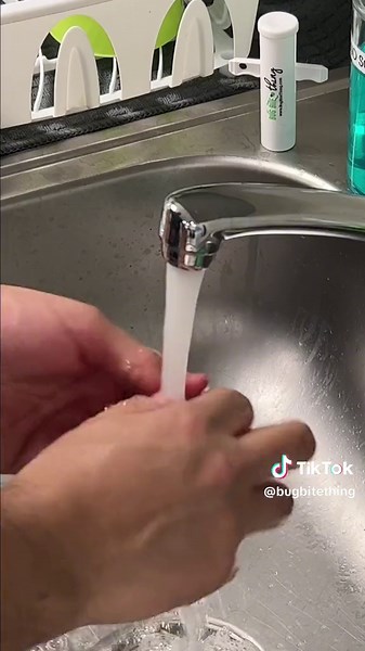 Bug Bite Thing on TikTok