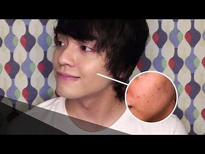 How I Cover up my Acne - Everyday Makeup Tutorial for Men | Joel Minas