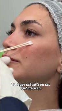 Χημικό peeling