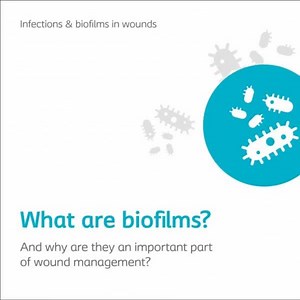 Biofilms are clusters of bacteria and fungi that may develop in the wound bed environment. When wounds are not healing as expected, the challenge may lie within biofilms. More evidence shows that biofilms are present in most, if not all, chronic and non-healing wounds. Because of their protective structure, biofilms are difficult to manage and often lead to persistent infection, inflammation and delayed healing. | Coloplast Wound and Skin Care