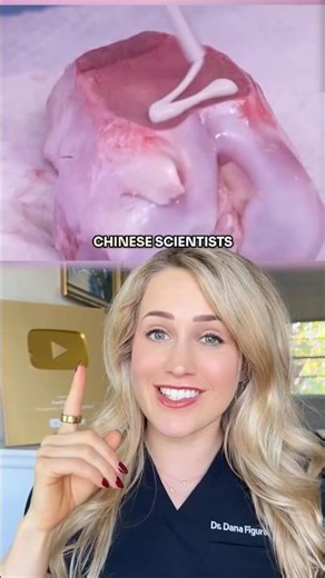 Doctor reacts: glueing bones together?!