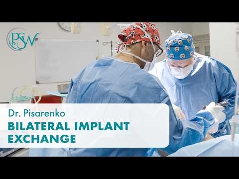 Bilateral Implant Exchange