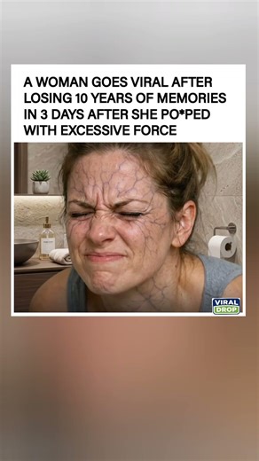 "The most unbelievable 3-day glow-down ever🔥😂."#trending #funny #viral