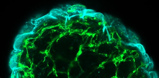 Miniature organs on chips could revolutionize health-care research