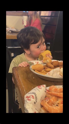 Understanding Campomelic Dysplasia and Its Impact