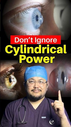 Cylindrical Power Increasing? Don’t Ignore This 😳