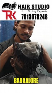 Hair Patch Results You Won’t Believe! | Bangalore