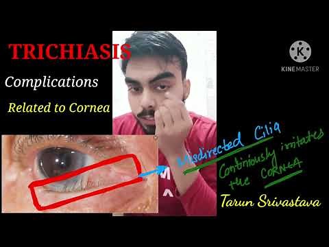 TRICHIASIS - Complete explanation of disease with its causes , complications and treatment