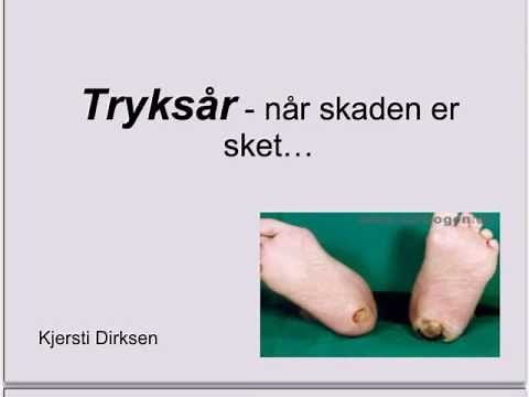 Forebyggelse og behandling af tryksår.