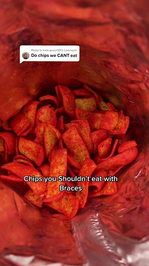 Reply to @kate.grace101 Pretty much all the ‘-os’ #braces #chips #learnontiktok