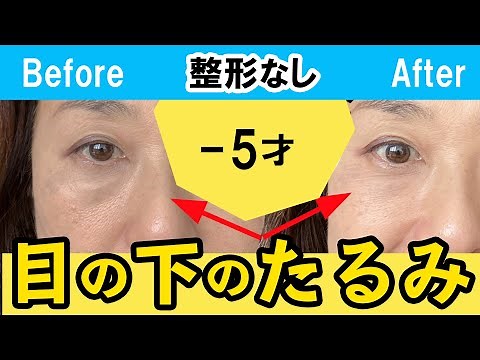 1週間で激変！目の下のたるみ整形級で取る！マッサージ＆エクササイズ ためしてガッテン
