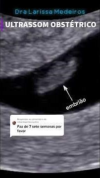 7 SEMANAS DE GESTAÇÃO | Ultrassom Obstétrico