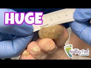 HUGE LONG NAILS TREATMENT