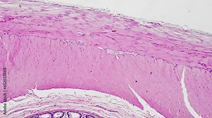 Section of human colon filmed under medical 100x microscope in scientific laboratory for healthcare check. Oncology screening of digestive system organ. Looking for tumor or other illness concept