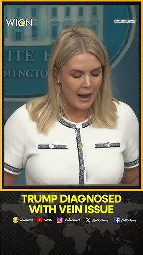 Trump Diagnosed With Vein Condition After Complaining of Swollen Legs: White House | WION Shorts