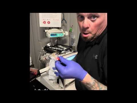 Snap and tap on Nxstage home hemo