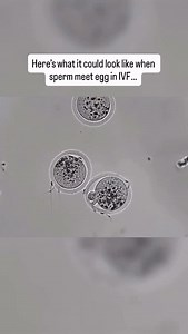 The process of fertilisation is an amazing art of science. Here is a real time video of the process of fertilisation where a sperm tries to penetrate the egg and fertilise it. | Yuvraj Jadeja
