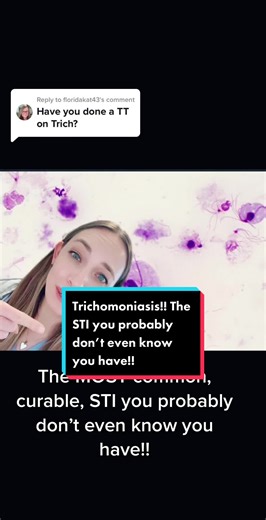 Replying to @floridakat43 #greenscreen Trichomoniasis!! #sti #trich #trichomonas #trichomoniasis #std #sticheck #seggsualhealth #learnontiktok #HolidayOREOke