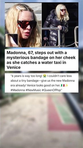 Madonna, 67, steps out with a mysterious bandage on her cheek as she catches a water ... #celebrity
