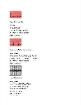 Ace The Relias Dysrhythmia Basic Test 2025 2026 Comprehensive Qa Guide For A First Try Pass