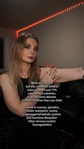 4.5K views · 91 reactions | 11% of women are affected by Lipedema —...