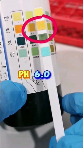 Urine reagent strips #urinalysis #urine #urinedipstick