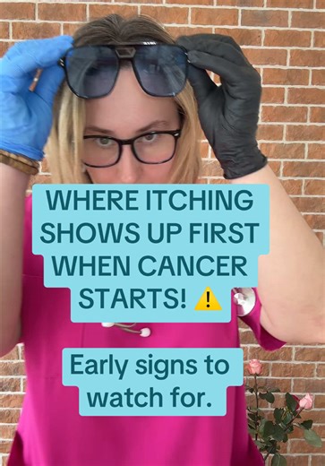 Understanding Itching as a Potential Early Cancer Sign