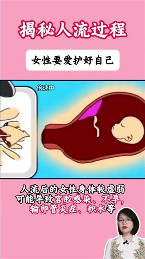Sự thật về phá thai – Góc nhìn y khoa và xã hội