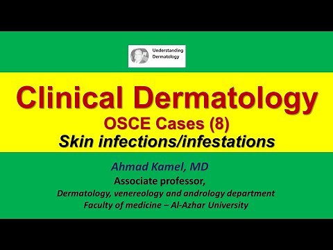 Clinical Dermatology OSCE Cases 8 Skin Infections and Infestations
