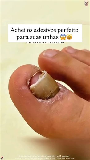 ACHADINHOS DIRA on Instagram: "LINK NOS STORIES OU COMENTA “EU QUERO “ PARA RECEBER O LINK 💗 🌺 Produto SIGA NOSSO PERFIL✨ para não perder nenhum achadinhos top 💞✨ 🚨O Link te encaminha direto para o produto na loja sempre disponível e 3 lugares para acessar : ♥️Link nos story por 24 hrs 💞Link na minha bio 💫Link nos destaques 281-381 🛍️Da shopee diretamente para : ✨Compartilhem com os amigo/a esse achado para aproveitar esse achadinho : #shopee#publi"