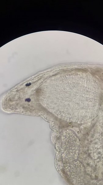 Check Out Those Little Eyes — An Amazing Flatworm Find