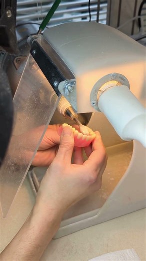 Craftmanship 〡SHUSWAP DENTURE CENTRE #denture #shuswap #salmonarm