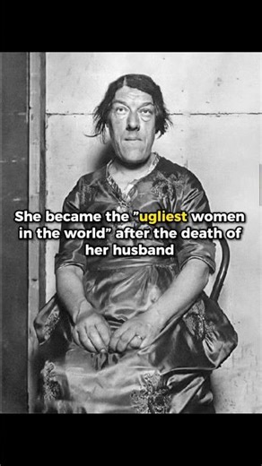 The Tragic Story of the Ugliest Woman in the World #shorts #truestory