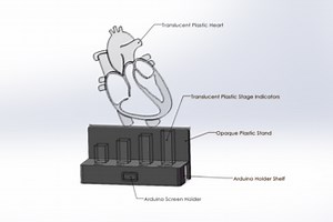 Congestive Heart Failure Educational Model