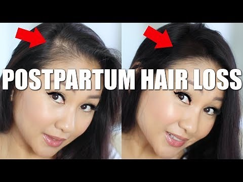 HOW TO HIDE POSTPARTUM HAIR LOSS!