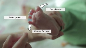 68K views | Medical knowledge distilled: Study smarter. Not harder. Learn how to perform a Neurological Examination! If you are a medical student, try AMBOSS! | AMBOSS | Facebook