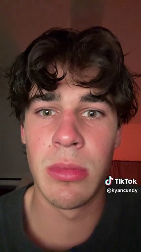 one of these eyes is definitely lazy #arancarter #fypシ