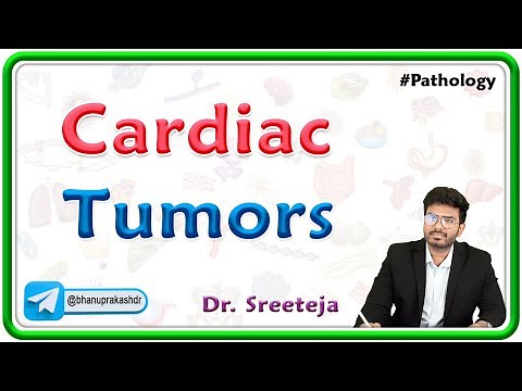 5: Cardiac Tumors | Pathology USMLE Step 1 🫀
