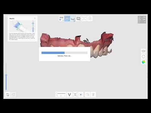 Virtual mounting using Medit i500 and meditlink face scan