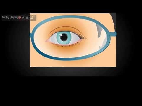 Spherical vs Aspherical Glasses Lenses