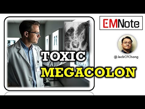 Toxic Megacolon