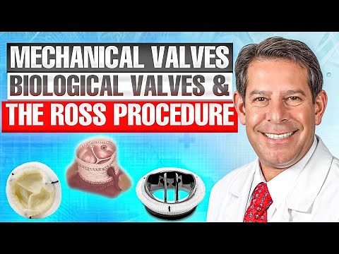 Evaluating Mechanical Valves, Biological Valves and the Ross Procedure