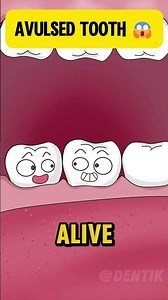 Avulsed Tooth Emergency Here's What You Need to Know! tooth animation