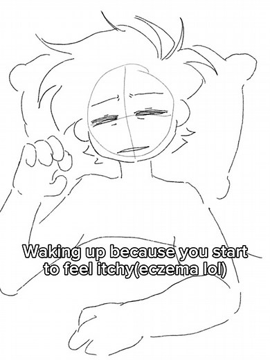 Fnaf movie coming soon guys!!🤩 | eczema hands popping