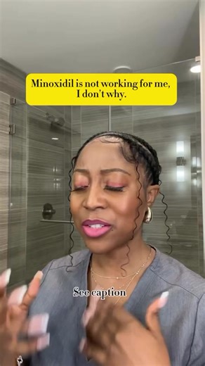 Why Minoxidil Might Not Work for Some People 👉🏾 Minoxidil isn't a one-size-fits-all solution for hair loss. It’s mainly approved for androgenic alopecia. 👉🏾 Doctors sometimes use it for other types of hair loss, but it doesn’t always work. 👉🏾 5% strength is usually better than 2%. 👉🏾 Apply to the scalp, not the hair, for best results. 👉🏾 It takes 4-6 months to see changes, so be patient. 👉🏾 Avoid oils that can block absorption. 👉🏾 Some people’s hair just doesn’t respond. 👉🏾 Combi