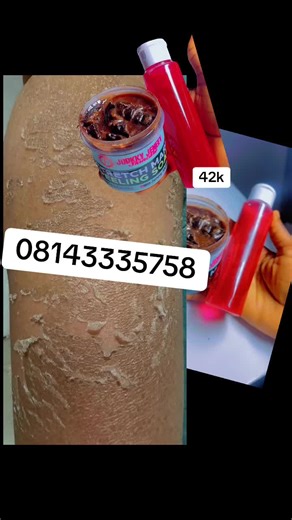 Effective Stretch Mark Remedies and Exercises